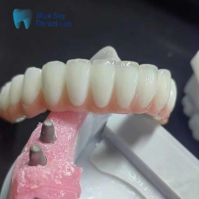 kupować Zwykły zestaw z implantami z cyrkonii, personalizowany zestaw z implantami dentystycznymi online manufacture
