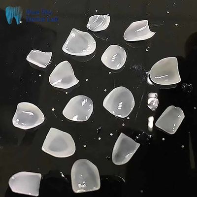 kupować Ultracienkie finery E Max klasy ingot ceramiczne naturalnie wyglądające finery online manufacture