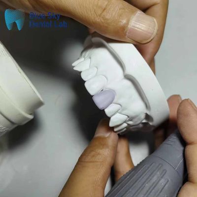 kupować 0.3mm Cienkie szkło ceramiczne implanty z winowaniem online manufacture