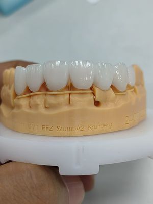 kupować 5mm-6mm Krony z cyrkonia powłoki Wytrzymałość Krona z cyrkonia wielowarstwowa online manufacture