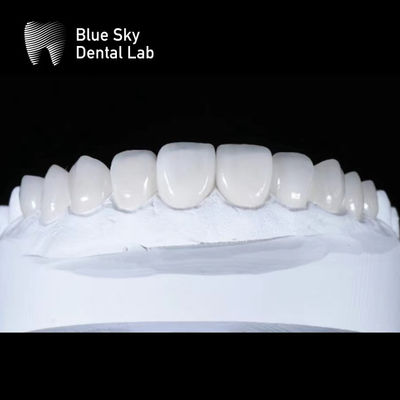 kupować Wyroby z gładkiej foliiery Premium 0,3 mm Ultra Thin Emax Foliiery online manufacture