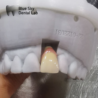 kupować Zwyczajne obudowy implantów Uniwersalna kompatybilność Obudowa implantów dentystycznych online manufacture