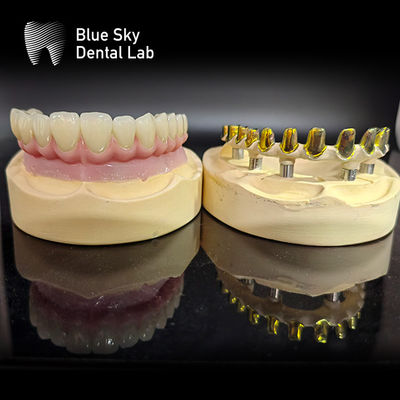 kupować Śruby utrzymane MUA pionowe Implant Case Zirconia korony Wielowarstwowy różowy porcelan z łatwą naprawą online manufacture