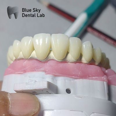 kupować Uniwersalna obudowa implantów zębowych kompatybilna z wieloma systemami implantów online manufacture