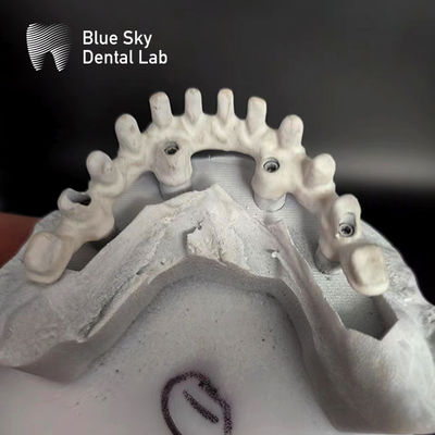 kupować Czyste Tytanowe Ramy Malo Most Dostosowywalny Implant Niebieskiego Nieba online manufacture
