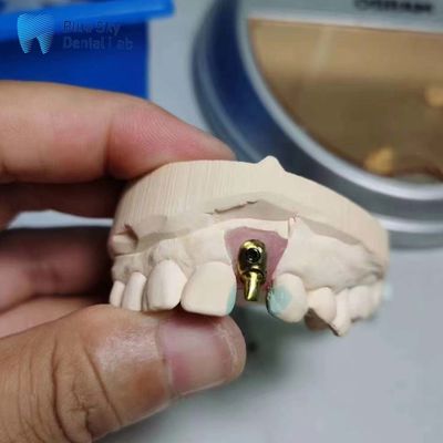 kupować Standardowe obudowy implantów, dopasowane do potrzeb, pojedyncze implanty zębowe, obudowa implantów z przodu online manufacture