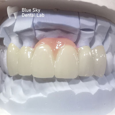 kupować Korony z zirkonia z warstwami Różowa porcelana Zirkonia Korona dentystyczna do odnowy estetycznej online manufacture