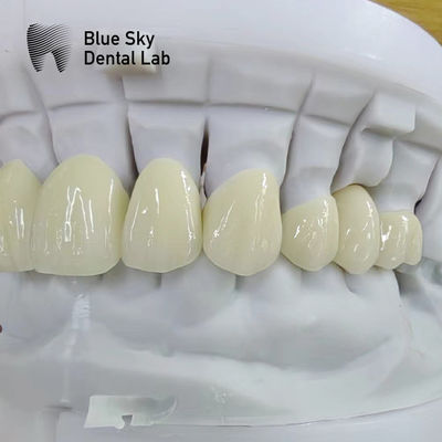 kupować Przejrzystości warstwowe Zirconia Crown Restauracja zębów Wielowarstwowa Zirconia Crown online manufacture