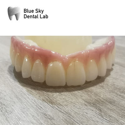 kupować Kompatybilność Obudowy implantów Systemy regularnych implantów Obudowy dentystyczne online manufacture