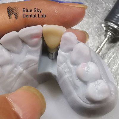 kupować Badania zgodności biologicznej Scenariusze implantacji Sterylizacja parowa online manufacture