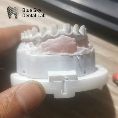 kupować Zastosowalny Industrial Malo Bridge W Srebro I Złoto Malo Implant Bridge online manufacture