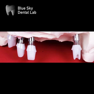 kupować Błękitne niebo Implanty zębowe Zirconia Abutment Precyzyjnie mielony online manufacture