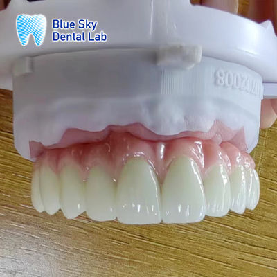 kupować Metal Frame Titanium Malo Bridge Dostosowalny Malo Implant Bridge online manufacture