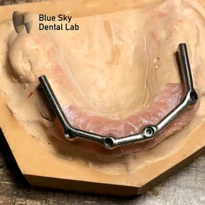 kupować Całkowity górny zęb Titanium Bar Całkowite usta Restauracja Błękitne niebo Implant online manufacture