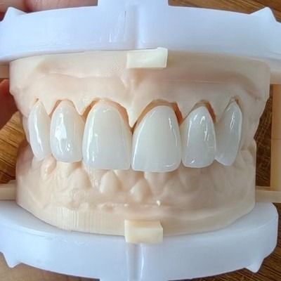 kupować Powierzchniowy Zirkonia dla naturalnej estetyki zrobić piękny uśmiech i dobrej restauracji mają certyfikat FDA i CE online manufacture