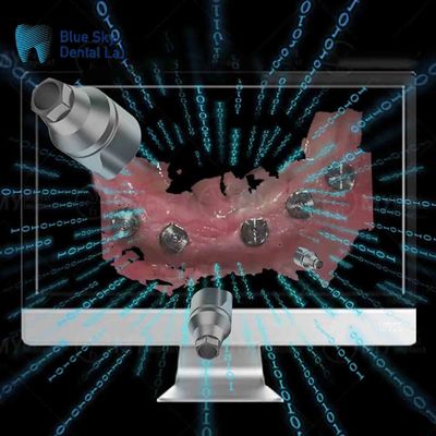 Wykorzystane wielokrotnie Implant bezpośrednie badanie ciała wszystkie w jednym badanie zębów ciała