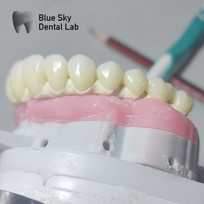 Czyste Tytanium Malo Implant Bridge Universal Metal Frame Malo Bridge