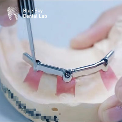 Precyzyjna stomatologiczna prętka tytanowa z cennym dodatkiem Biokompatybilna