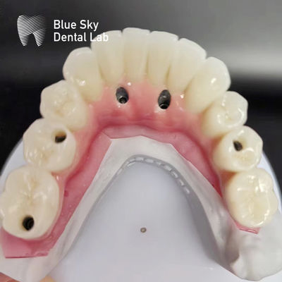 Całkowitego łuku z implantami zębnymi kompatybilne z wieloma systemami implantów