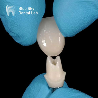 Wykrycie ustne Custom Zirconia Abutment Wysokiej wytrzymałości Zirconia Abutments