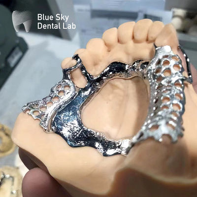 Błękitne niebo ramy dentystyczne częściowe protezy szczękowe ramy metalowe