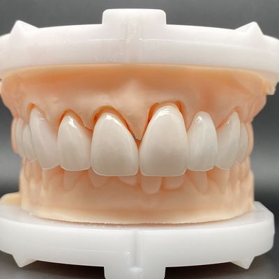 EMax Fener Case Passive Fitting W Wielu Kolorach Wykonaj Piękny Uśmiech Z Minimalnym Przygotowaniem Zębów
